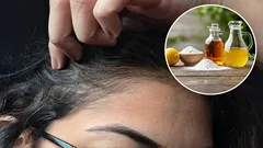 白髪を落とすために酢と重曹を使うメリットは何ですか？また、正しい使い方はどうですか？